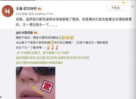 男医生看网红整容鼻子,审美趋势与风险并存